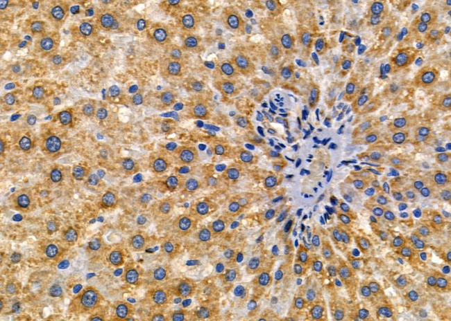 IL12RB1 Antibody in Immunohistochemistry (Paraffin) (IHC (P))