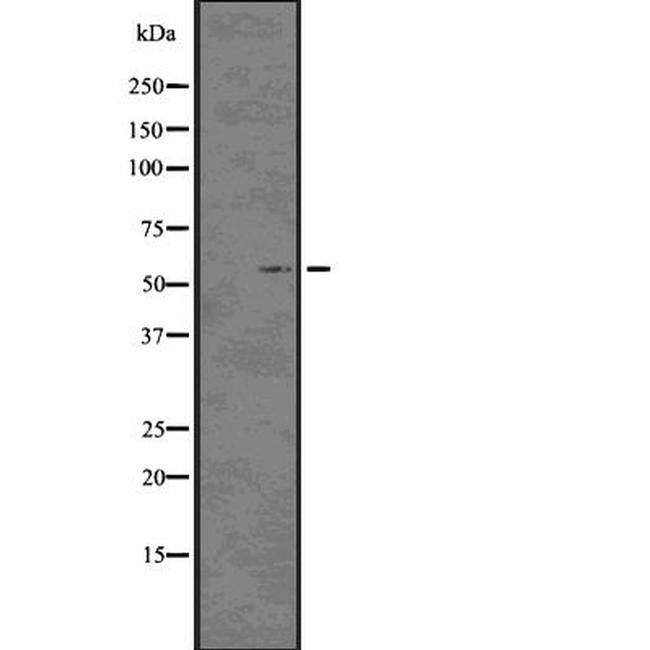 Phospho-p57 Kip2 (Thr310) Antibody in Western Blot (WB)