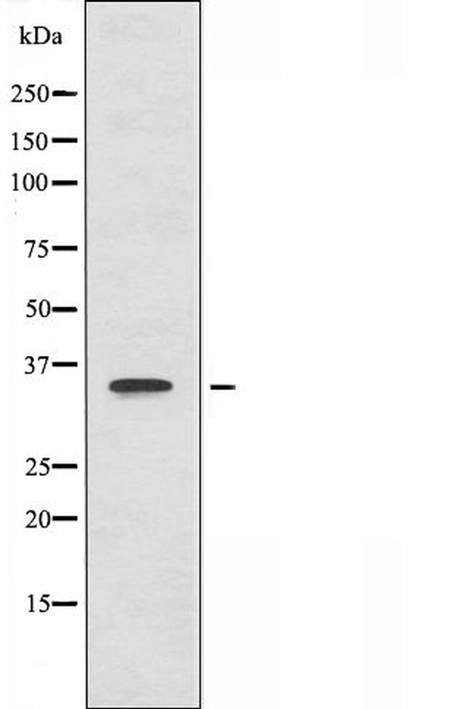 BRAF35 Antibody in Western Blot (WB)