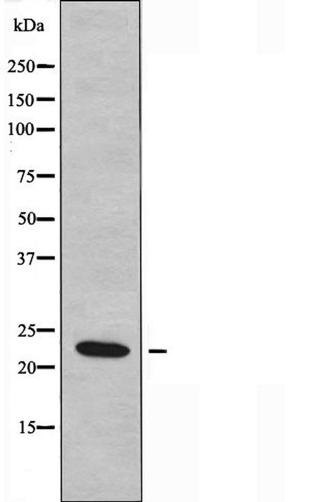 RASL10B Antibody in Western Blot (WB)