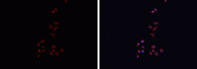 HLA-DRA Antibody in Immunocytochemistry (ICC/IF)