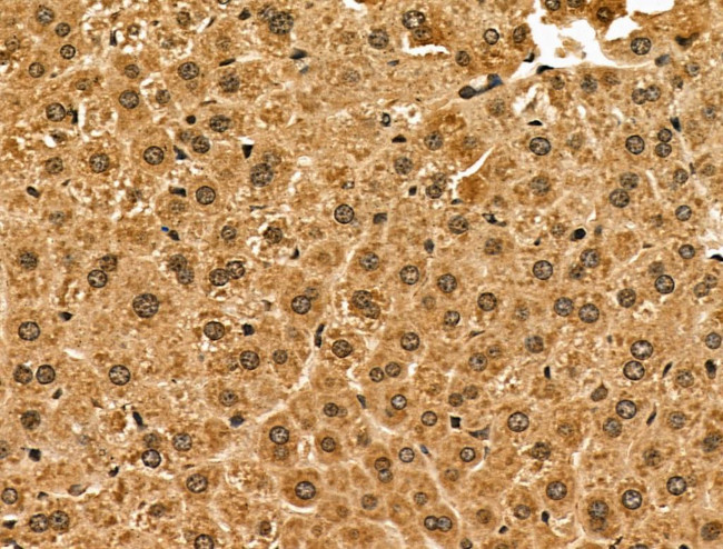 ABCG8 Antibody in Immunohistochemistry (Paraffin) (IHC (P))
