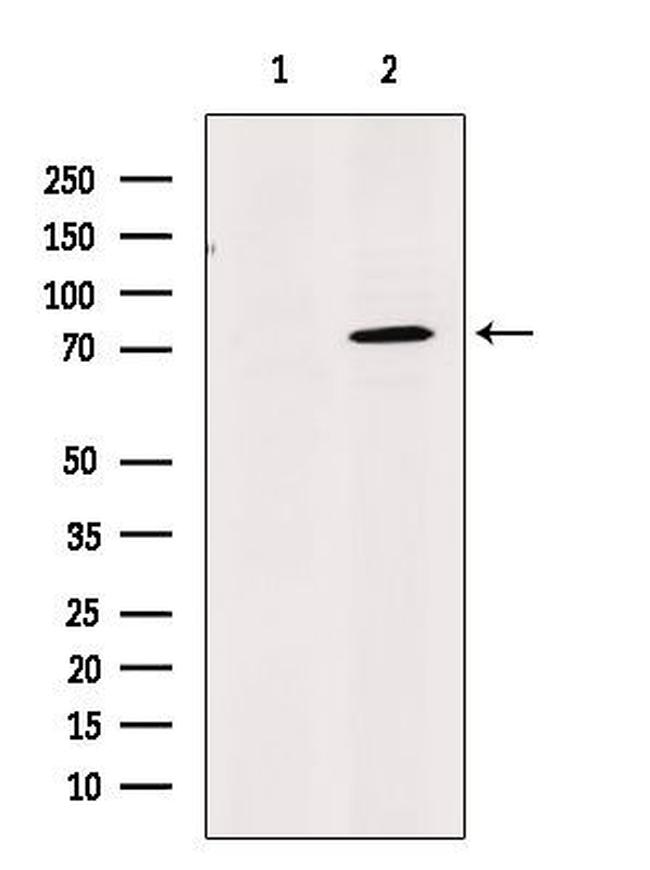 LAP2 alpha Antibody in Western Blot (WB)