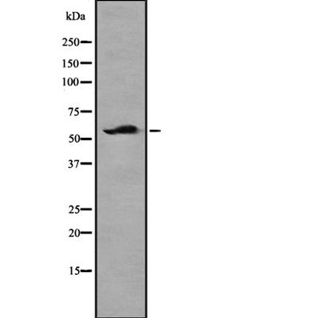 NETO2 Antibody in Western Blot (WB)