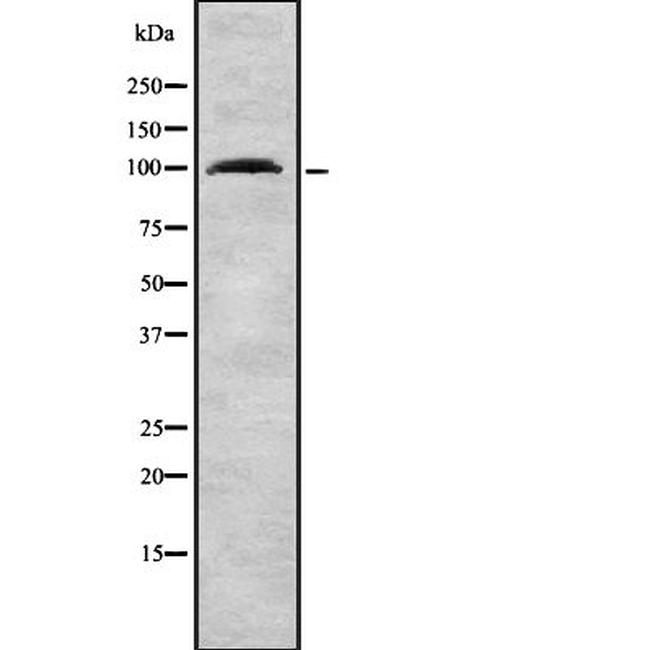 TNPO3 Antibody in Western Blot (WB)