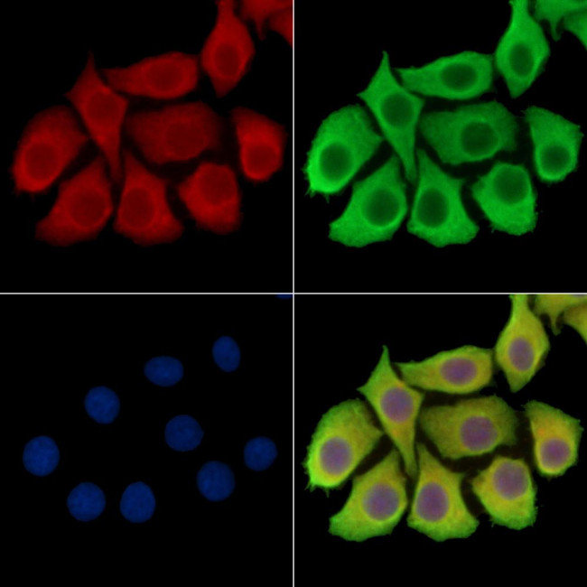 TRBC1 Antibody in Immunocytochemistry (ICC/IF)