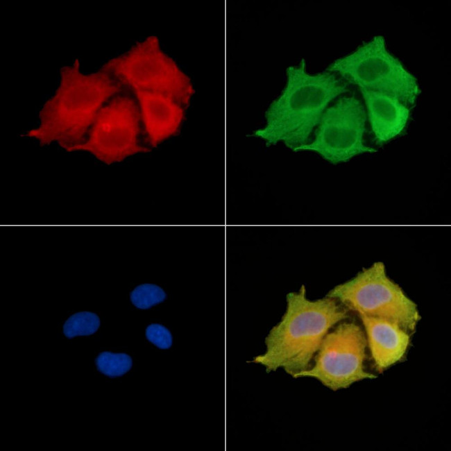 KRT81 Antibody in Immunocytochemistry (ICC/IF)