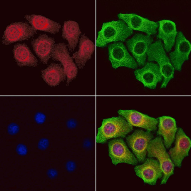 BCCIP Antibody in Immunocytochemistry (ICC/IF)