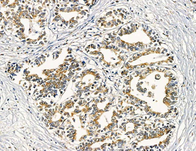 Claudin 9 Antibody in Immunohistochemistry (Paraffin) (IHC (P))