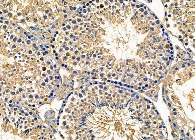 RhoGAP4 Antibody in Immunohistochemistry (Paraffin) (IHC (P))