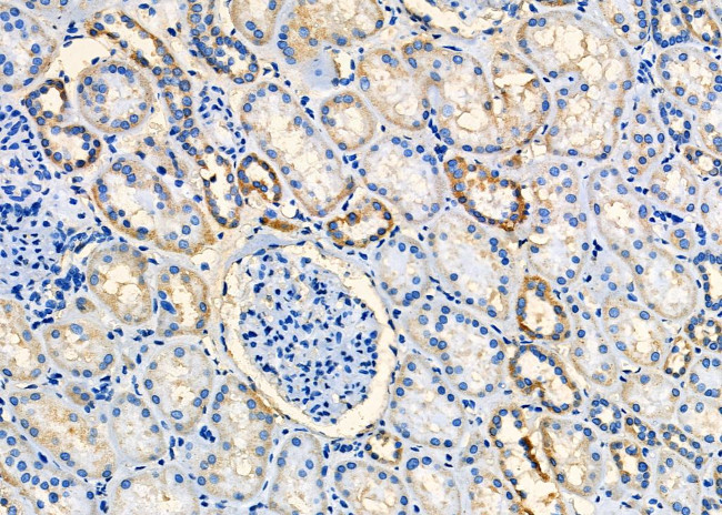 CCL27 Antibody in Immunohistochemistry (Paraffin) (IHC (P))