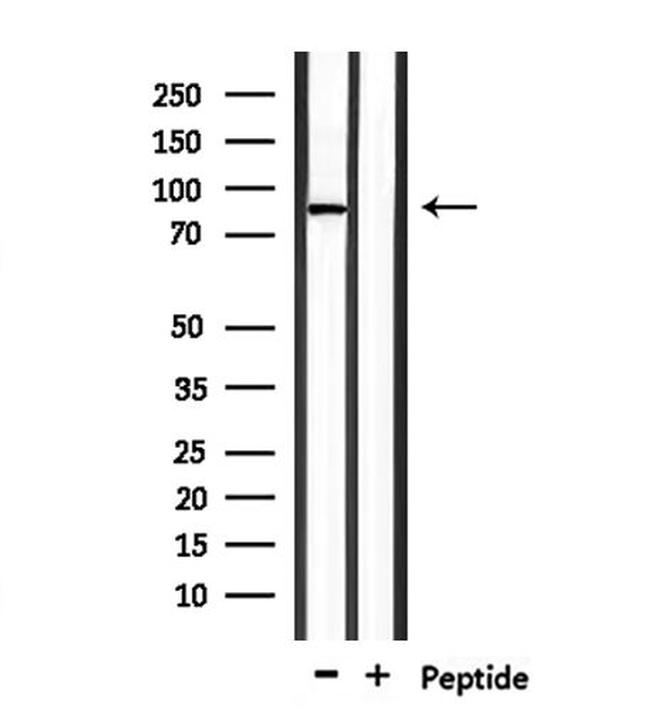 TMC7 Antibody in Western Blot (WB)