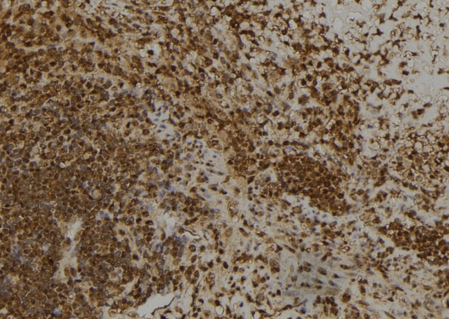 CAPG Antibody in Immunohistochemistry (Paraffin) (IHC (P))