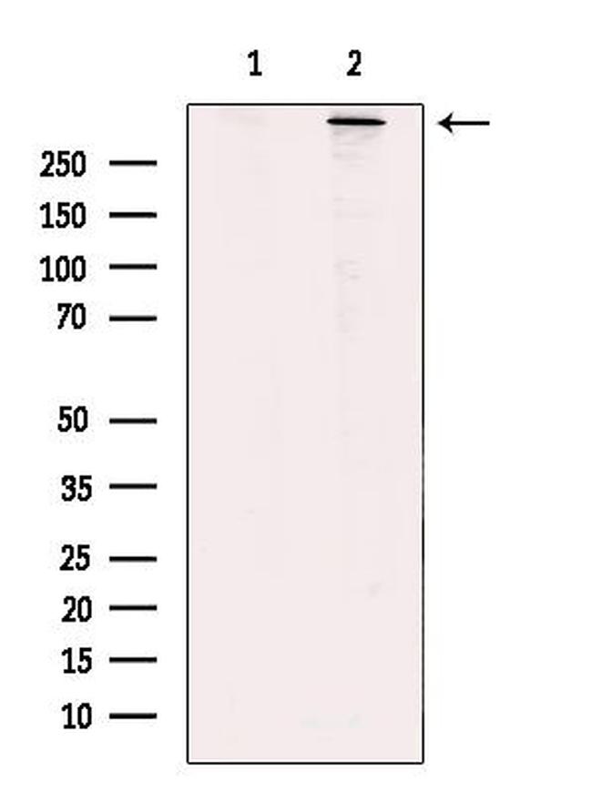 RyR2 Antibody in Western Blot (WB)