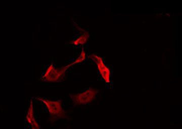 Phospho-RIP2 (Ser176) Antibody in Immunocytochemistry (ICC/IF)