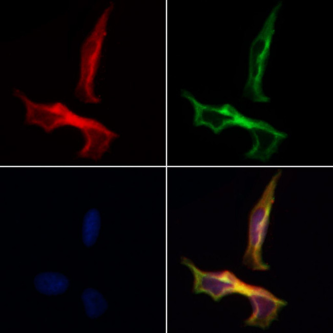 14-3-3 beta/zeta Antibody in Immunocytochemistry (ICC/IF)