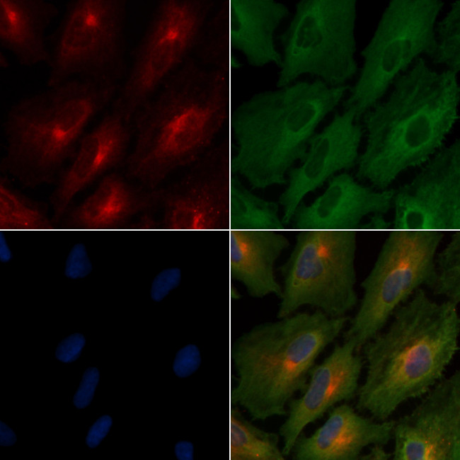 RON Antibody in Immunocytochemistry (ICC/IF)