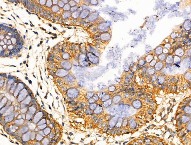 CARD6 Antibody in Immunohistochemistry (Paraffin) (IHC (P))
