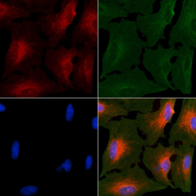 Peripherin Antibody in Immunocytochemistry (ICC/IF)