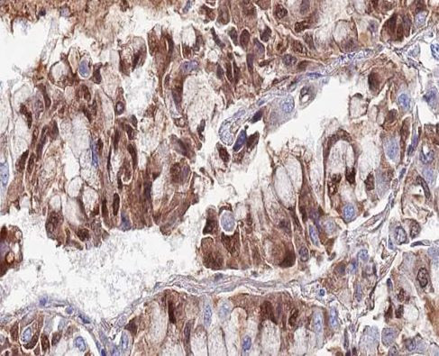 SENP5 Antibody in Immunohistochemistry (Paraffin) (IHC (P))