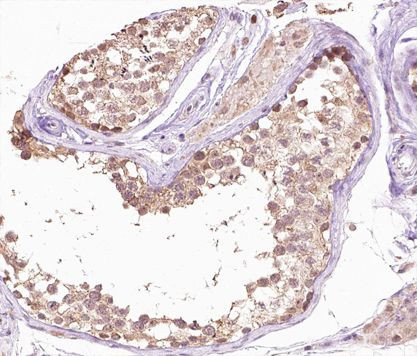 SENP6 Antibody in Immunohistochemistry (Paraffin) (IHC (P))