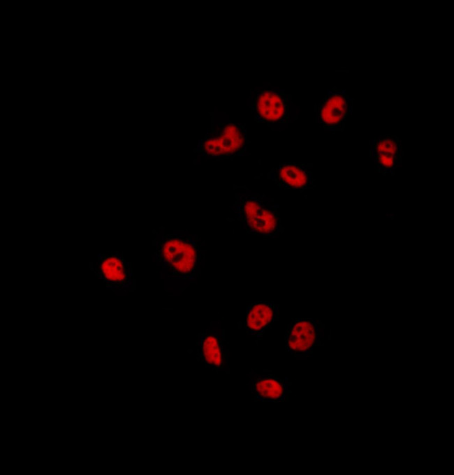 UBA2 Antibody in Immunocytochemistry (ICC/IF)