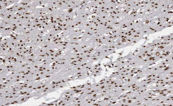 USF2 Antibody in Immunohistochemistry (Paraffin) (IHC (P))