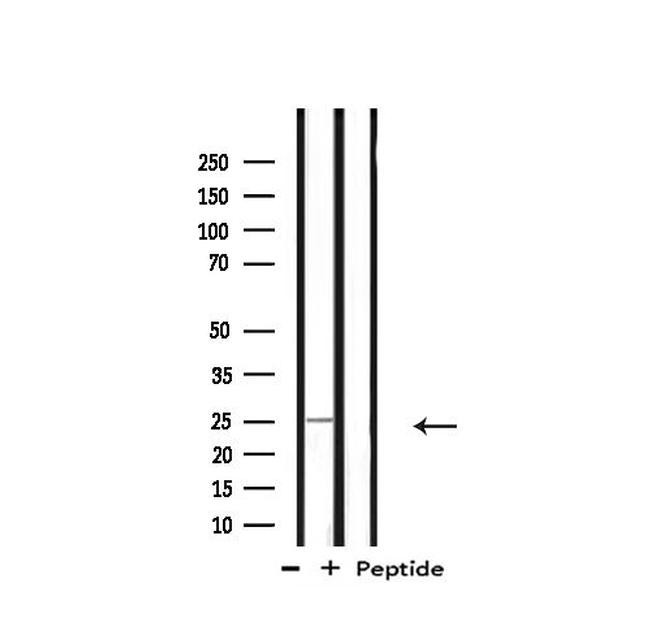 RPL10 Antibody in Western Blot (WB)