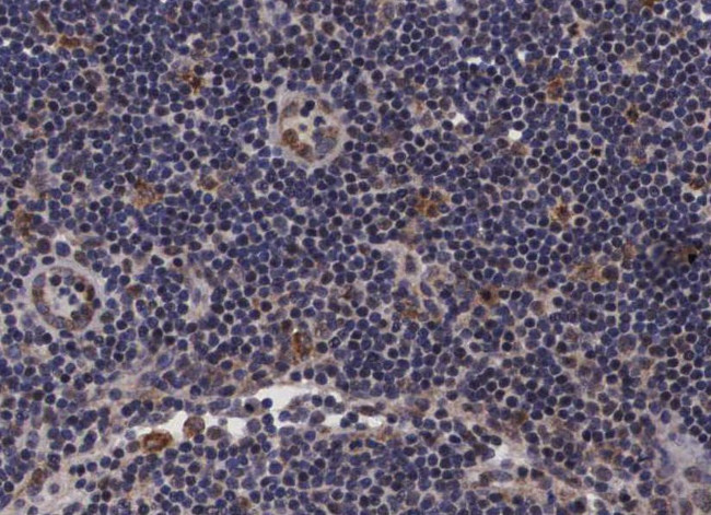 PDZD2 Antibody in Immunohistochemistry (Paraffin) (IHC (P))