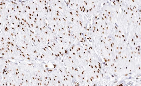 DLX3 Antibody in Immunohistochemistry (Paraffin) (IHC (P))