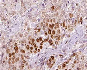 REV3L Antibody in Immunohistochemistry (Paraffin) (IHC (P))