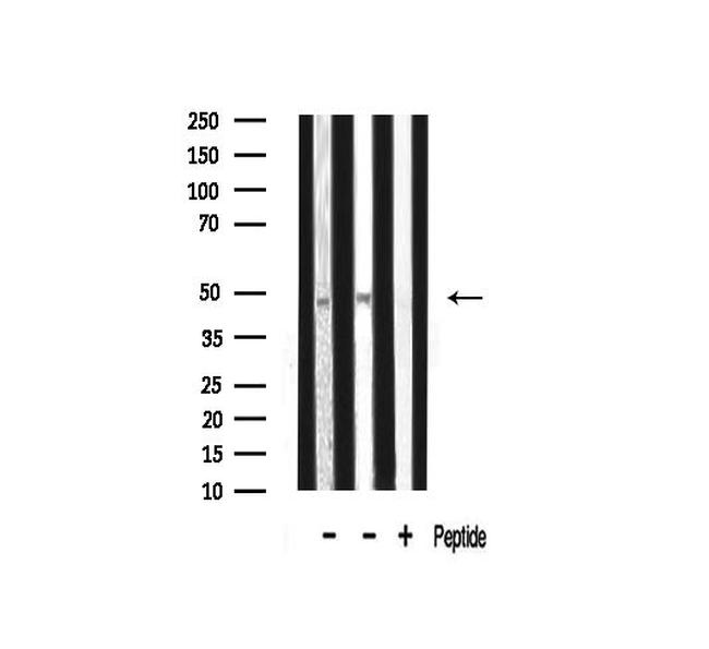 TADA2L Antibody in Western Blot (WB)