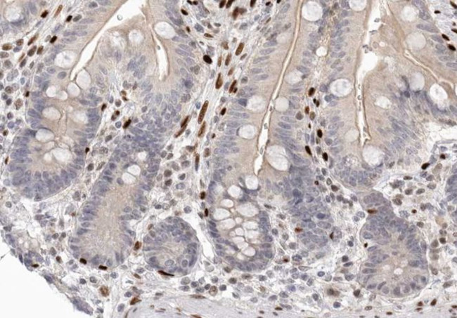 CDK2AP2 Antibody in Immunohistochemistry (Paraffin) (IHC (P))