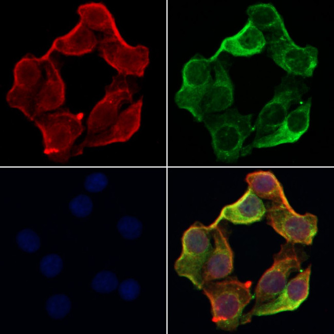 TAP Antibody in Immunocytochemistry (ICC/IF)