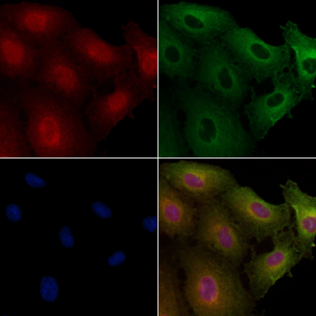 DMC1 Antibody in Immunocytochemistry (ICC/IF)
