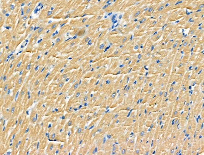 RPS9 Antibody in Immunohistochemistry (Paraffin) (IHC (P))