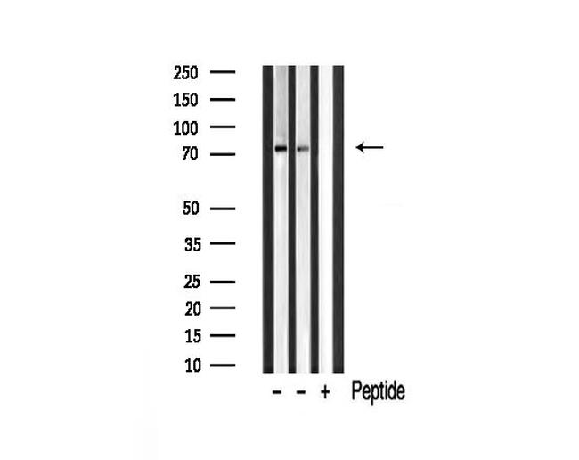 MAN1B1 Antibody in Western Blot (WB)