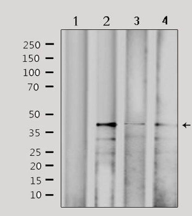 CBX6 Antibody in Western Blot (WB)
