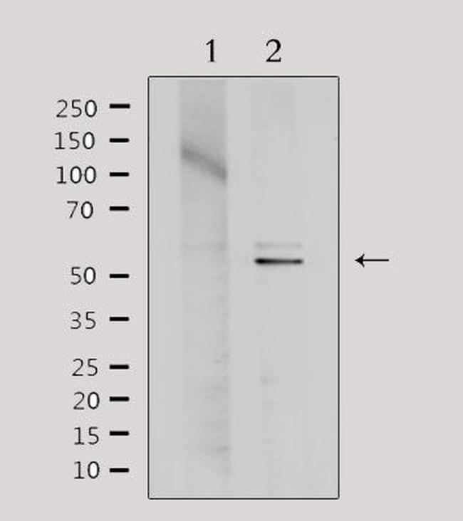 TIN2 Antibody in Western Blot (WB)