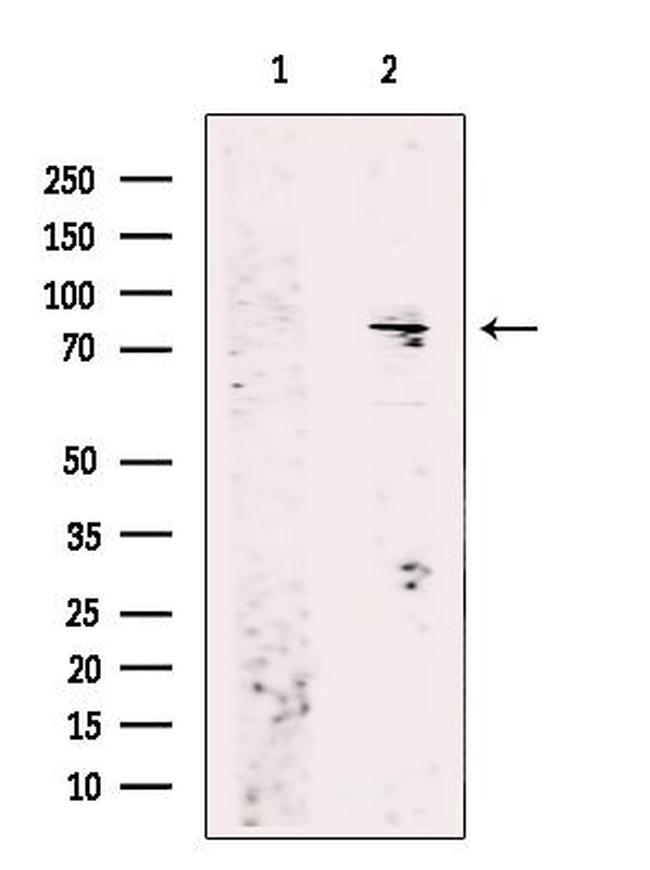 RhoBTB1/RhoBTB2 Antibody in Western Blot (WB)