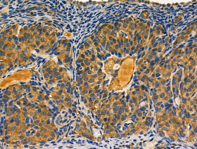 EPS8L2 Antibody in Immunohistochemistry (Paraffin) (IHC (P))