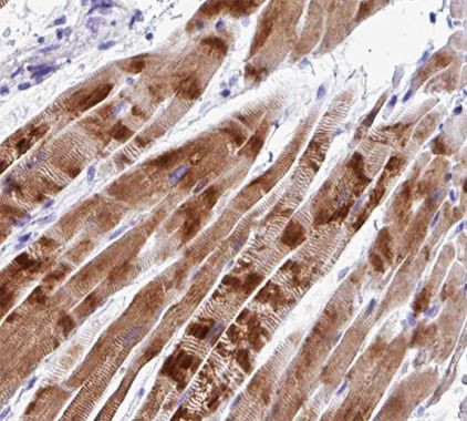 ECRG4 Antibody in Immunohistochemistry (Paraffin) (IHC (P))