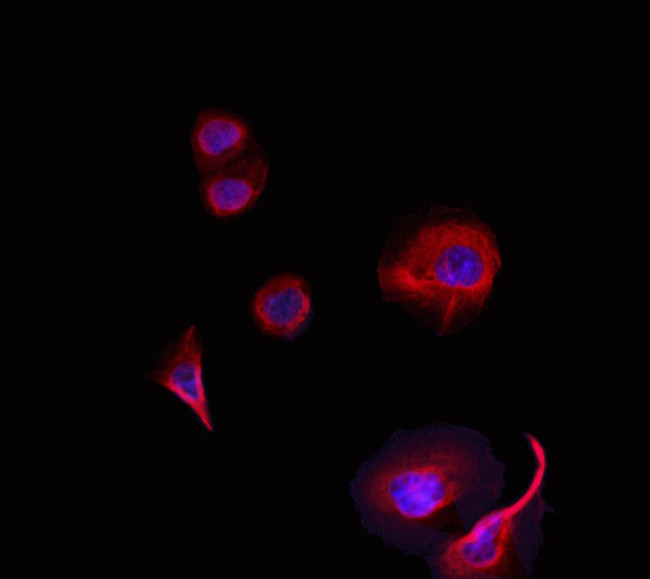 DIRAS1 Antibody in Immunocytochemistry (ICC/IF)