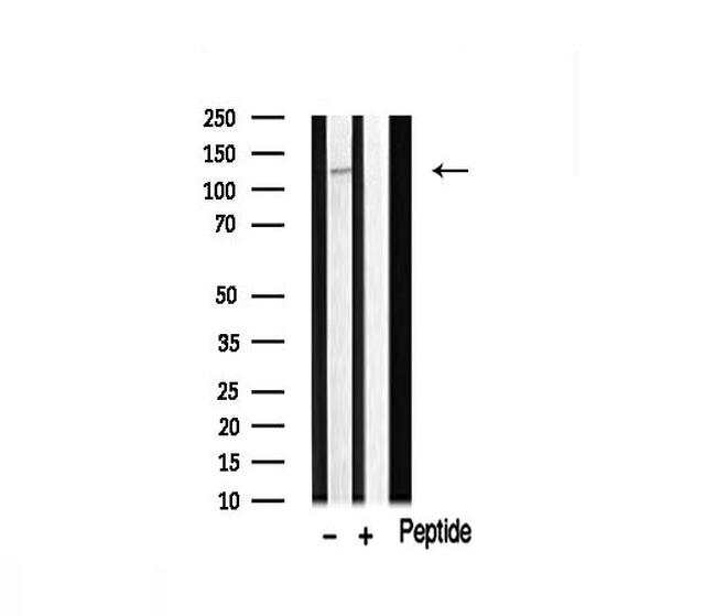 FIR Antibody in Western Blot (WB)