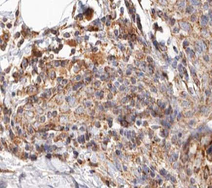 BCAR3 Antibody in Immunohistochemistry (Paraffin) (IHC (P))