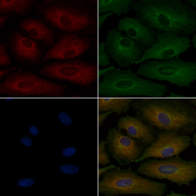 MRC2 Antibody in Immunocytochemistry (ICC/IF)