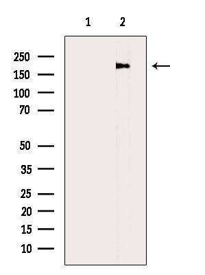 MAST2 Antibody in Western Blot (WB)