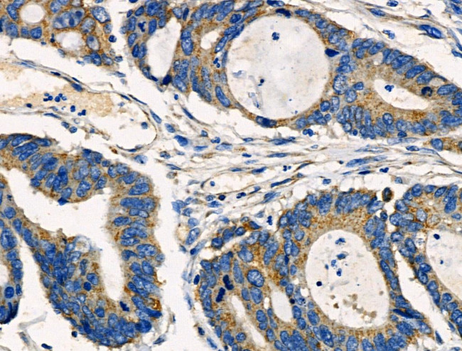 DOK3 Antibody in Immunohistochemistry (Paraffin) (IHC (P))