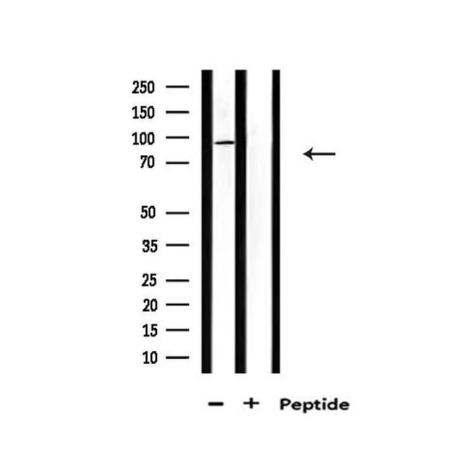CDK11A/CDK11B Antibody in Western Blot (WB)