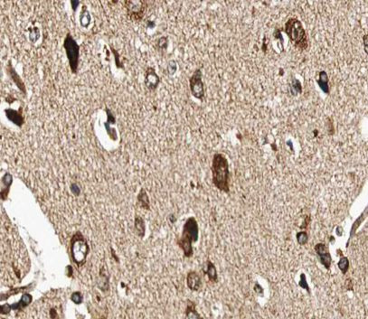 GUCY1B3 Antibody in Immunohistochemistry (Paraffin) (IHC (P))